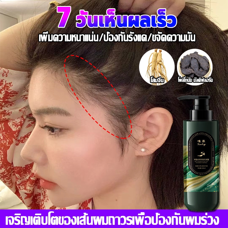 7วันให้ผลอย่างรวดเร็ว FCBSEN แชมพูปลูกผม 450ML โสม/โพลีโกนัม ผมขาวถึงดำ เร่งผมยาว แชมพูขิง กำจัดรังแค ป้องกันผมร่วง