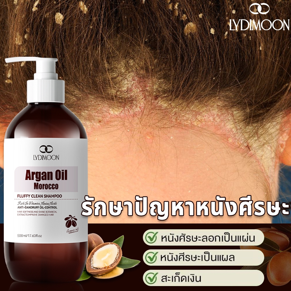 ยาสระผมขจัดรังแค แชมพูรังแค ยาสระผม 500ml ขจัดรังแค ลดคันหัว หยุดอาการคัน ลดผมร่วง แชมพูรักษาเชื้อราบนหนังศรีษะ