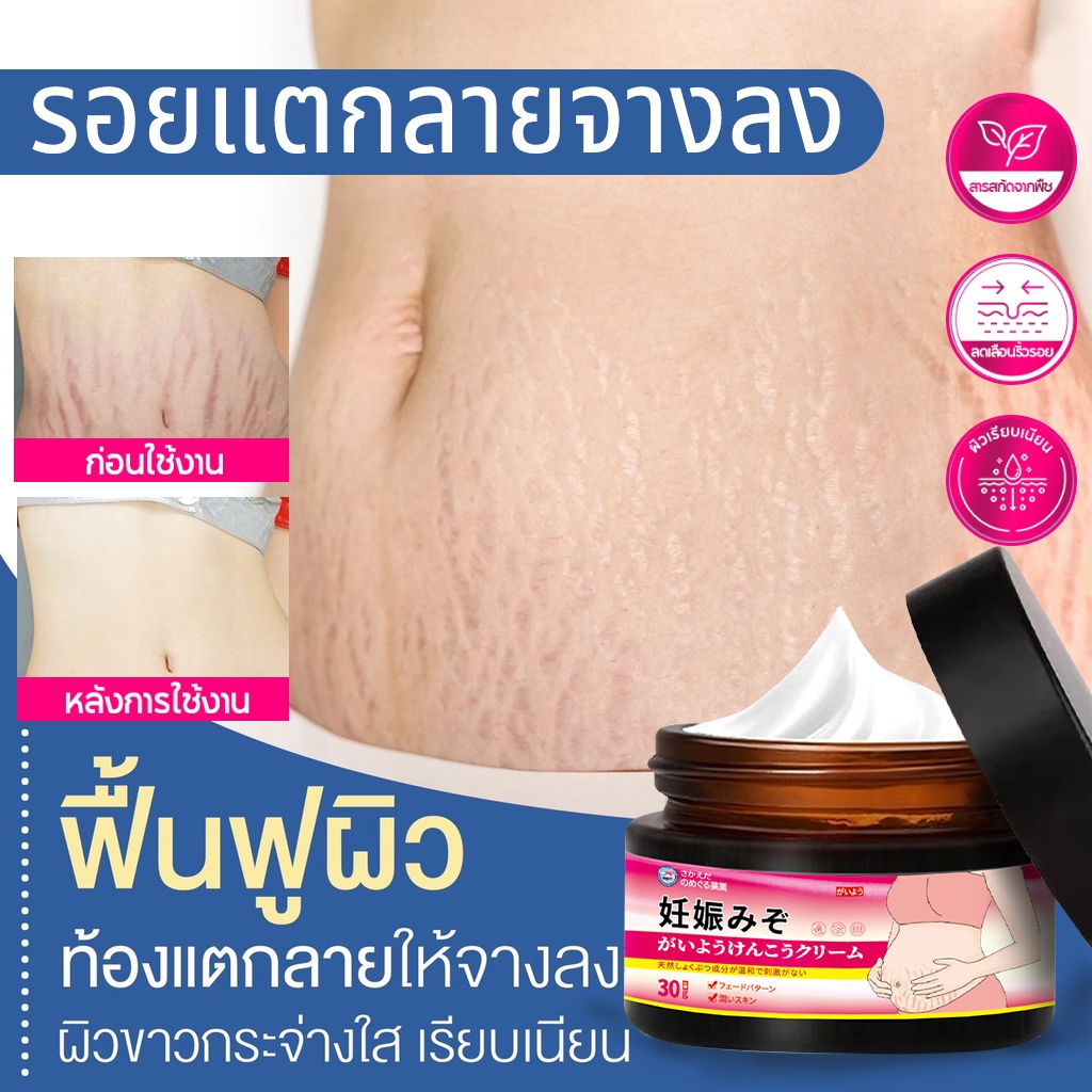 ครีมทาท้องลาย รอยแตกลาย ลดรอยแผลเป็น ลดรอยแตกลาย ท้องลาย ริ้วรอยจากการตั้งครรภ์ Stretch Mark Cream 30g ครีมบำรุงผิว