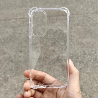 เคสใสแข็ง สำหรับ Samsung A54 A24 A34 A14 A23 A13 A04 A04S A03 A03S A73 A53 A33 เคสคิงคอง เคสใสกันกระแทก