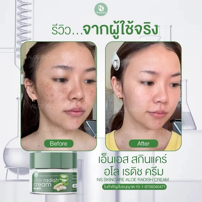 2กระปุก190ครีมว่านหัวไชเท้าบาทเอ็นเอสสกินแคร์อโลเรดิชครีม thumbnail 4