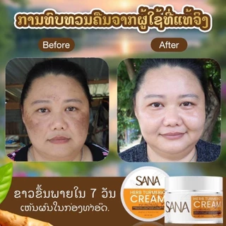 Sana Herb Turmeric Cream ซาน่า เฮิร์บ ครีมขมิ้นสด ฝ้า กระ จุดด่างดำ หน้าคล้ำ ผิวแพ้ง่ายใช้ได้ 5กรัม