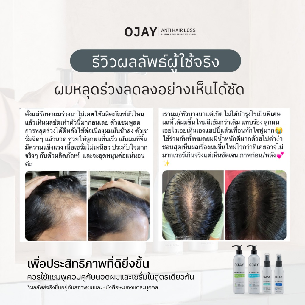 [Duo Set] OJAY Anti Hair Loss Shampoo & Conditioner 250ml ลดผมร่วง รูปที่ 7