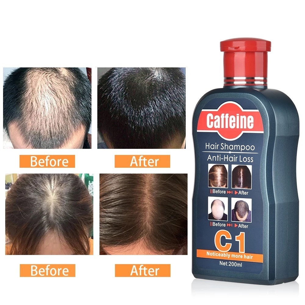 แชมพูลดผมร่วง Caffeine Anti Hair Loss Shampoo แก้ผมบาง เร่งผมยาว บำรุงเส้นผมและหนังศรีษะ ขนาด 200 ml