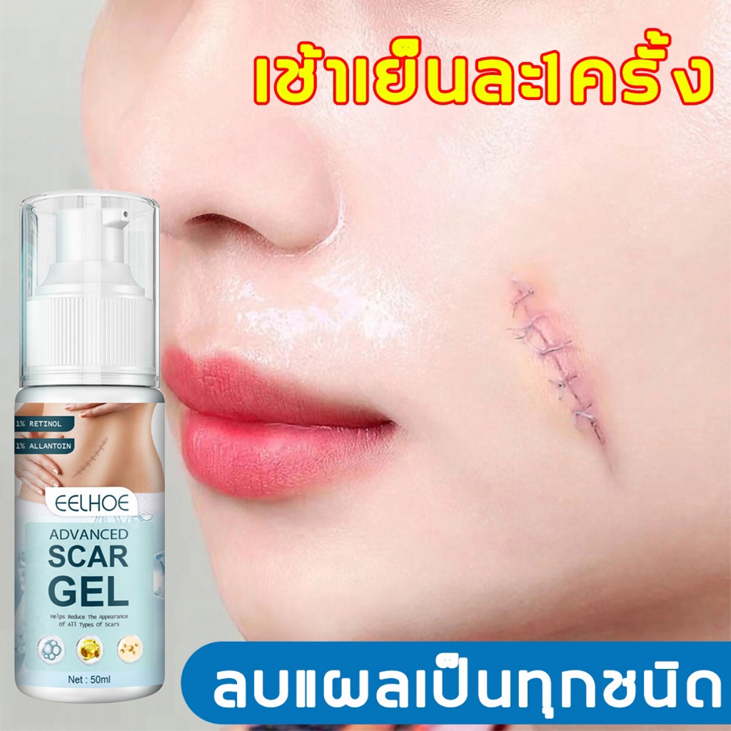 เจลทารอยแผลเป็น 50ml แผลเป็น ครีมเลือนรอยแผลเป็น เลือนแผลเป็นไฟไหม้ แผลน้ำร้อนลวก แผลผ่าตัดเป็นต้น