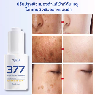 377 ครีมแก้ฝ้ากระ ครีมแก้ฝ้า 30ml ครีมหน้าขาว ครีมปรับปรุงผิว ครีมบำรุงผิว ไวท์เทนนิ่ง ครีมแก้ฝ้าไวท์เทนนิ่งผิว ครีมแก้ฝ