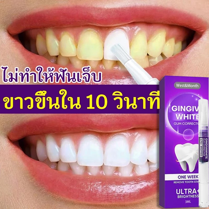 ปากกาฟอกสีฟัน เจลทําความสะอาดฟัน อำลาฟันเหลือง ขจัดคราบฟัน ทำความสะอาดฟันดำการฟอกสีฟัน เจลฟอกฟันขาว