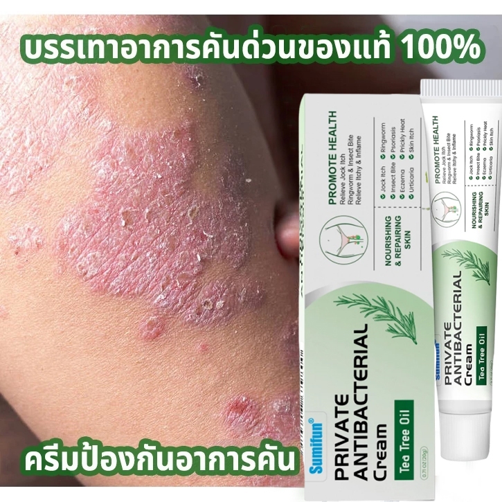 ☘️ครีมทาสังคัง สะเก็ดเงินครีม ครีมบำรุงผิว 20g รอยแดง โรคผิวหนัง เกลื้อน กลาก คัน สมุนไพร แก้คันเรื้อรัง คันในร่มผ้า