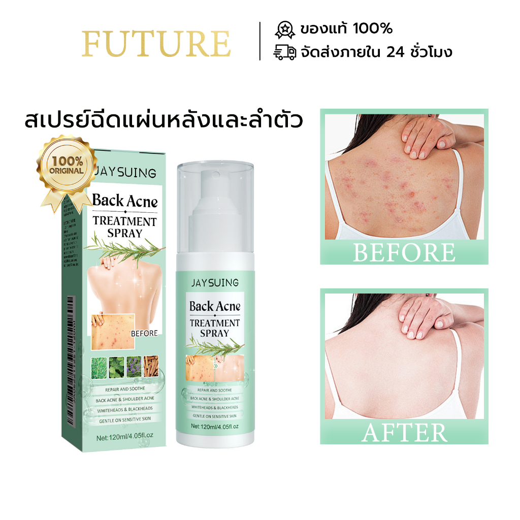 Jaysuing สิวที่หลัง แอคเน่ สเปรย์ฉีดแผ่นหลังและลำตัว ลดไรและสิวตามร่างกาย กำจัดสิวที่หลังและลำตัว ครีมแต้มสิว acne spray