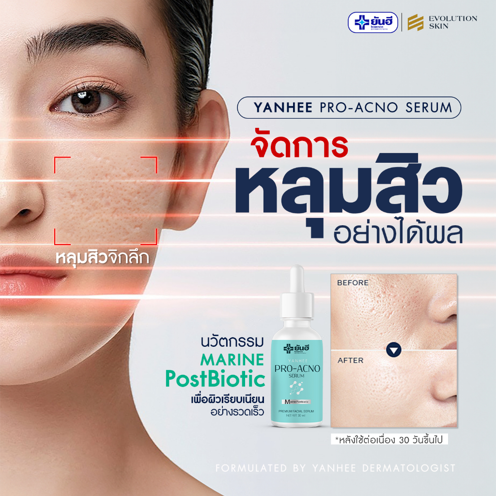 [ ของแท้ มีบัตรตัวแทน ] Yanhee Pro Acno Serum เซรั่มสิว ยันฮีโปรเอกโน่ หลุมสิว ควบคุมความมัน