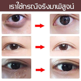 เม็ดไขมัน 30ml ลบคล้ำบวมใต้ตา กระชับรอยตีนกา ลดเม็ดไขมัน ฟื้นฟูผิวตา ครีมทารอบดวงตา เซรั่มอายครีม อายครีม
