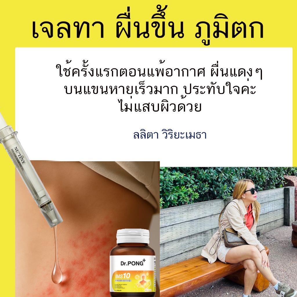 เจลทาผื่นผื่นแพ้อากาศ pantip แพ้อากาศเย็น ผื่นคัน วิธีแก้ เป็นผื่นคันตามตัว ไม่หาย Pantip ยาแก้แพ้ ผ