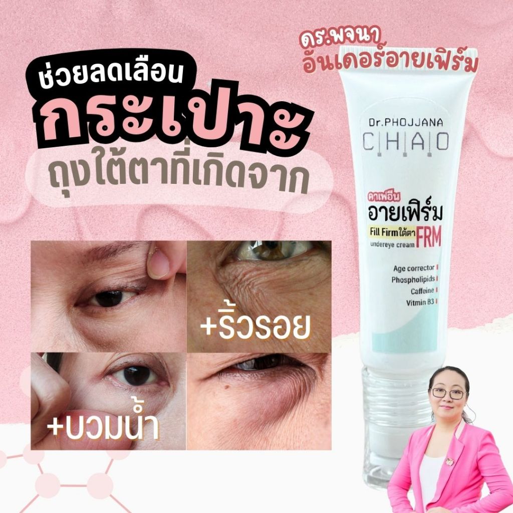 🔰สูตรกระเปาะใต้ตา🔰อันเดอร์อายครีม อายเฟิร์มผิวใต้ตา ที่บวมน้ำ ริ้วรอย คลื่นใต้ตา FRM14 โดย ดร.พจนา