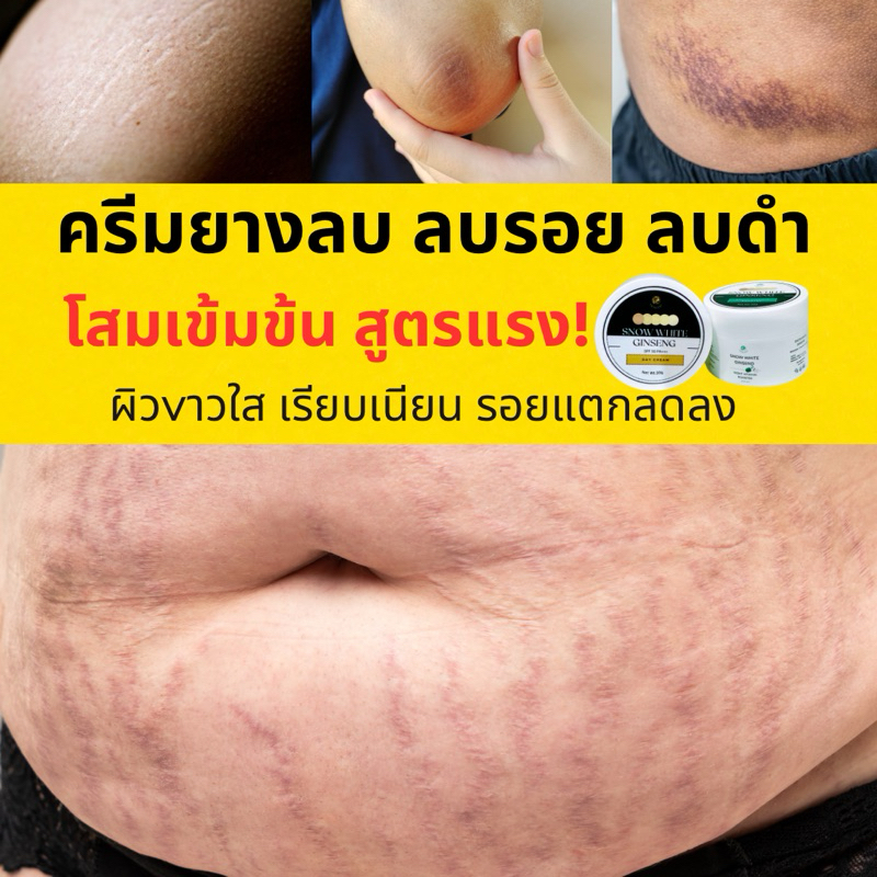 ครีมโสมกันแดดขั้นเทพ 1 แถม1 Intensive Ginseng Hya Vitamin Day + Night Cream ครีมโสม Hya+กันแดด SPF50