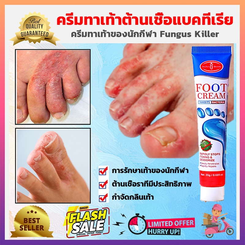 ขจัดปัญหาเท้าอย่างรวดเร็ว AiC ครีมดูแลเท้า ครีมระงับกลิ่นเท้า ครีมทาเท้าต้านเชื้อแบคทีเรีย กำจัดกลิ่นเท้า