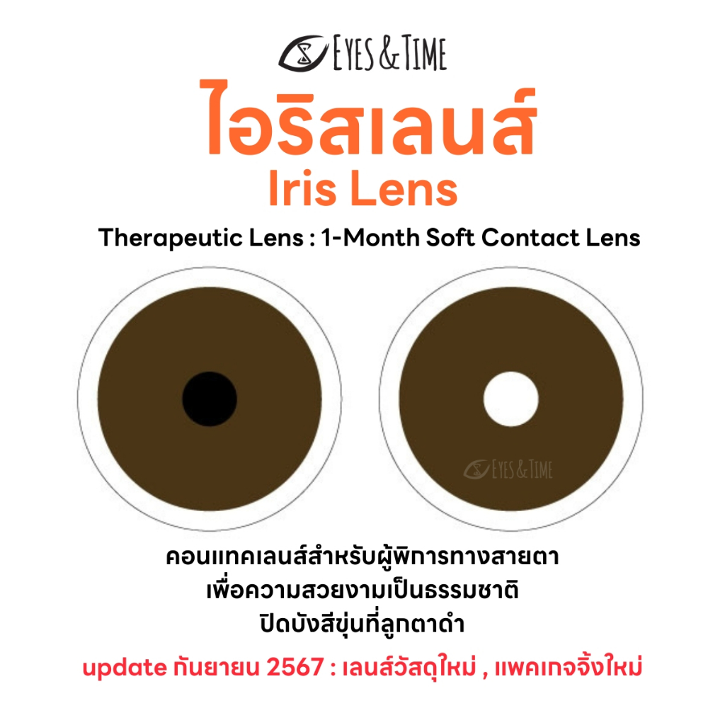 IRIS LENS คอนแทคเลนส์สำหรับผู้พิการทางสายตา สีน้ำตาลเข้ม (6 pcs.) ชนิดรายเดือน เพื่อความสวยงาม บังสี