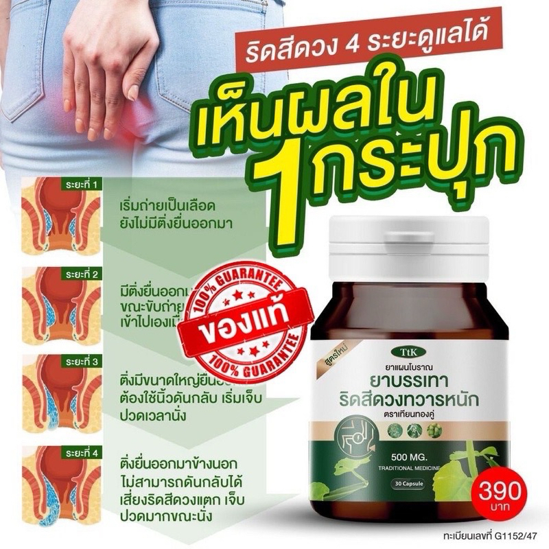 พร้อมส่ง ยาบรรเทาริดสีดวงทวาร ตราTtk (30เเคปชูล)