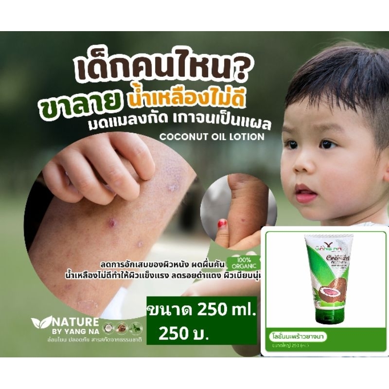 *ยางนา* โลชั่นสำหรับเด็ก จากน้ำมันมะพร้าวสกัดเย็น ขนาด 250 ml. รอยยุงกัด น้ำเหลืองไม่ดี ผิวแพ้ง่าย ผื่นคัน