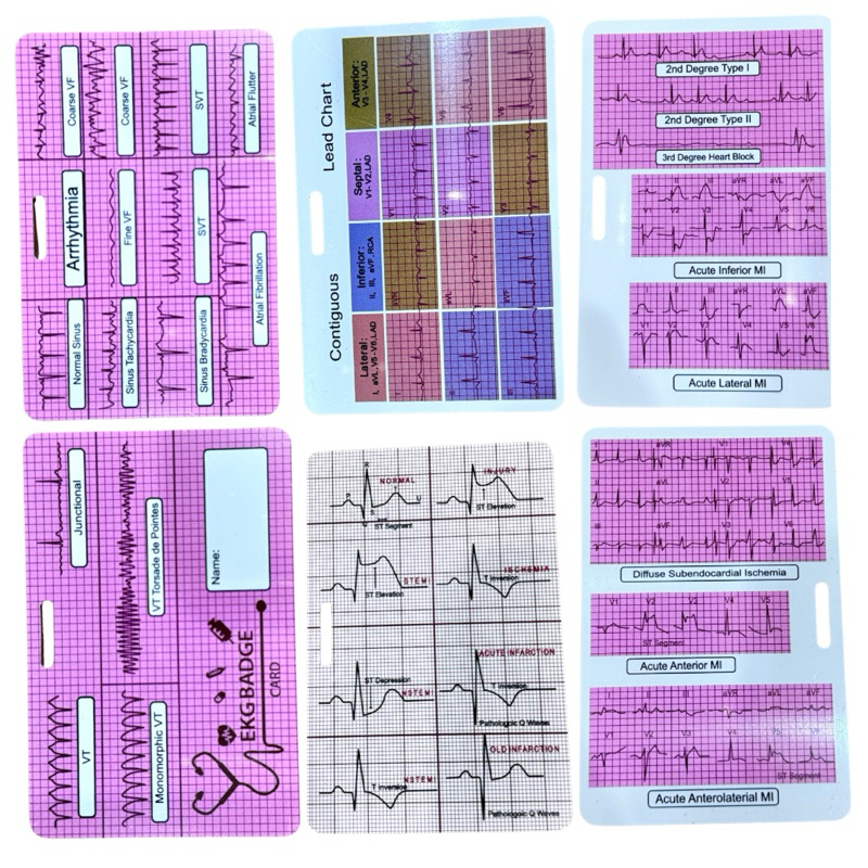 บัตรพกติดตัว EKG 3 ชิ้น (6หน้า)สำหรับพยาบาล/แพทย์ EKG leads badge buddy