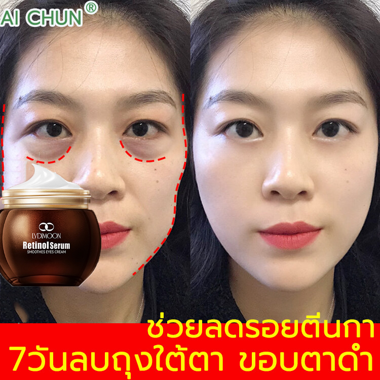 LYDIMOON  เรตินอลอายครีม อายครีม eye cream 5D 35g  ลดริ้วรอย ลดถุงน้ำใต้ตา ลดรอยคล้ําใต้ตา ลดริ้วรอยตีนกา ให้ความชุ่มชื้