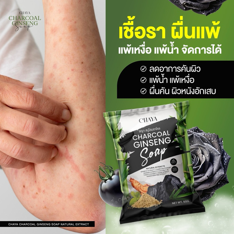 สบู่โสมชาโคล ดีท็อกซ์ผิว แก้คัน ลดสิว By.ชญา