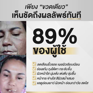 นิสิตซีจี NISIT CG [ 5 ขวด แถมฟรี นิสิต 1 ซอง ] เซรั่มขวดทอง กิ๊ก สุวัจนี 💥 คืนความอ่อนเยาว์ผิวหน้า เซรั่มไม่ยอมแก่