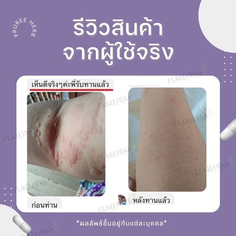 พลูคาวแคปซูล ตราภูรีเฮิร์บ 60 แคปซูล – ปัญหาผิวหนัง (ขายดี) ราคา ถูกที่สุด ดีลบีเคเค แกลเลอรีภาพที่ 9