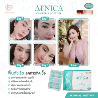 Ainica Centella☘️ไซส์ 30 เม็ด🌟 ยาลดบวมหลังศัลยกรรม ลดช้ำ แผลหายยุบไว ได้รับรองงานวิจัยสารสกัดจากสถาบันวิจัยจุฬา