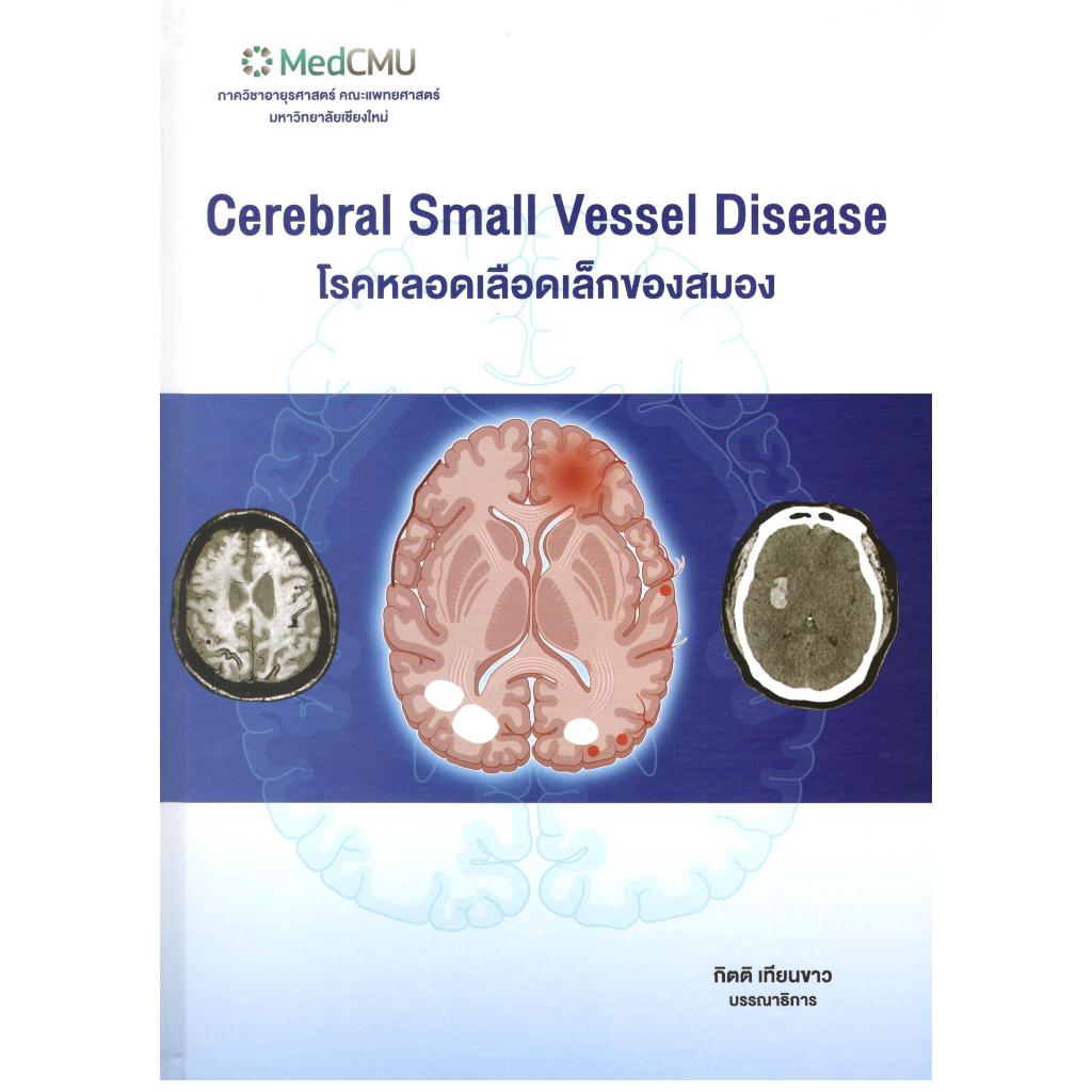 (ปกแข็ง) โรคหลอดเลือดเล็กของสมอง (CEREBRAL SMALL VESSEL DISEASE) 9786163989680