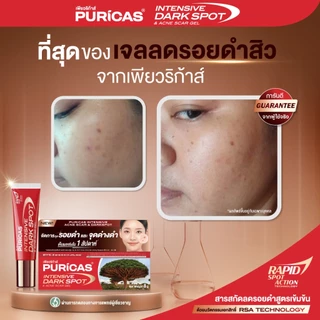 เซ็ตลดเลือนรอยสิว End of Acne Scar Set [ Scar Gel 8g + Intensive Dark Spot 8g.]