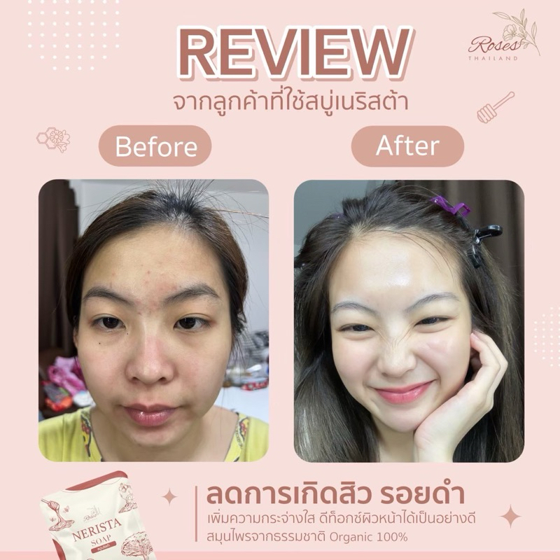 สบู่เนริสต้า🧸[ของแท้/ส่งไว] หน้าใส ลดสิว ลดผด ออแกนิก100% - รูปที่ 7
