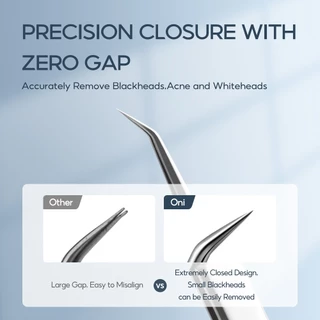 Oni Blackhead Remover Tweezers for Quick and Easy Removal of Pimples ที่กดสิว ชุดกดสิว อุปกรณ์กดสิว กำจัดสิวเสี้ยน