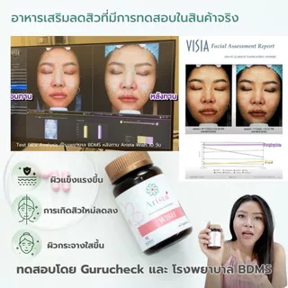 Set B โปรโมชั่น อริสต้า วิช 2 กระปุก ราคาพิเศษ