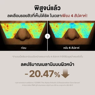 COSRX The Alpha-Arbutin 2 Discoloration Care Serum 50ml เดอะ อัลฟ่า-อาร์บูติน 2 ดิสโคโลเรชั่น จัดการรอยสิว ผิวหมองคล้ำ