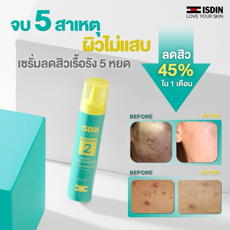 Acniben night  concentration ลด 5 สาเหตุสิว ผิวไม่แสบ พร้อมลดรอยแดง&ผิวมัน