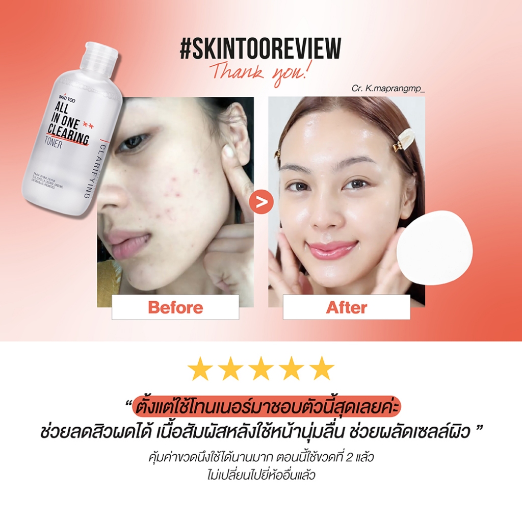 (Exp.12/2026)[1แถม1] โทนเนอร์ลดสิว ผิวกระจ่างใส SKINTOO ALL IN ONE CLEARING TONER - รูปที่ 4