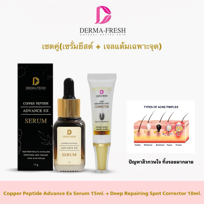 (เซตคู่)ดูแลผิวมีหลุมสิวเข้มข้นx2(copperสูตรยีสต์+เจลegf)