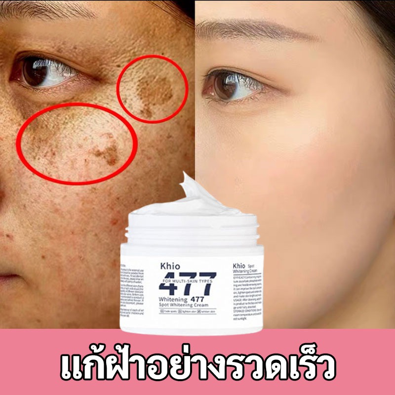 ครีมทาหน้า ครีมไวท์เทนนิ่ง 477 ไวท์เทนนิ่งครีม khio แก้ฝ้าปรับให้ผิวขาว ปรับปรุงปัญหาผิวแห้งหมองคล้ำ