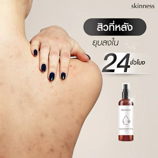 [พร้อมส่งทุกวัน] skinness acne clear body spray | สเปรย์ฉีดลดสิวบริเวณผิวกาย
