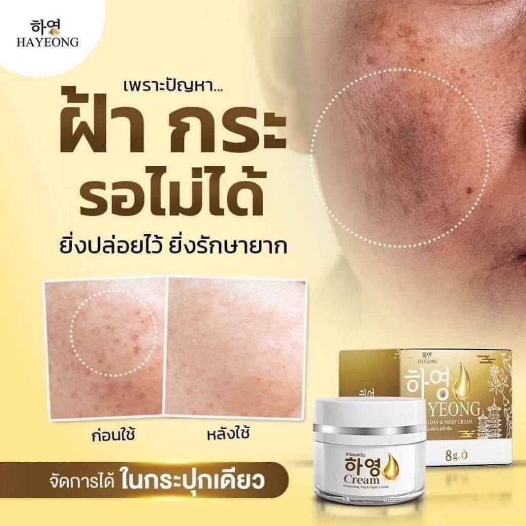 ⭐️Hayeon Cream ครีมฮายอง 1กระปุก แท้ พร้อมส่ง⭐️ จุดจบ ฝ้า กระ สลายลึกถึงต้นตอ ฝ้า กระ หายถาวร! ริ้วร