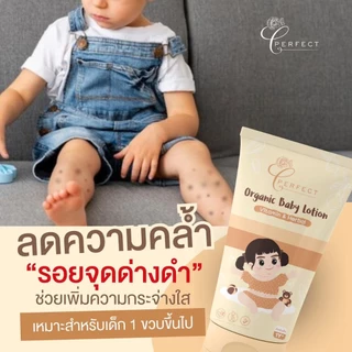 Perfect โลชั่นเด็ก บำรุงผิวขาว กระจ่างใส แก้ปัญหาขาลาย กู้ผิวคล้ำเสีย ลดรอยยุงกัด สูตรออร์แกนิค