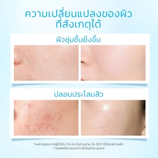 SKINTIFIC 2pcs เซรั่มเพื่อการผลัดเซลล์ผิว AHA BHA PHA LHA 5X เซราไมด์ ครีมบำรุงผิวหน้า มอยเจอร์ไรเซอร์ เซรั่มหน้าใส