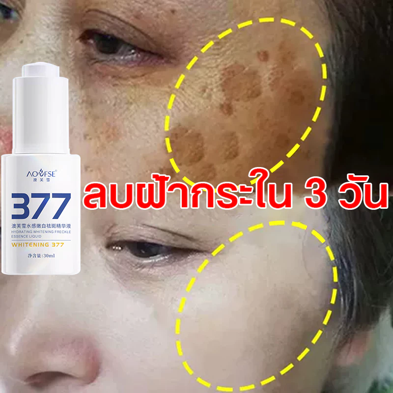 377 ครีมแก้ฝ้ากระ ครีมแก้ฝ้า 30ml ครีมหน้าขาว ครีมปรับปรุงผิว ครีมบำรุงผิว ไวท์เทนนิ่ง ครีมแก้ฝ้าไวท์เทนนิ่งผิว ครีมแก้ฝ