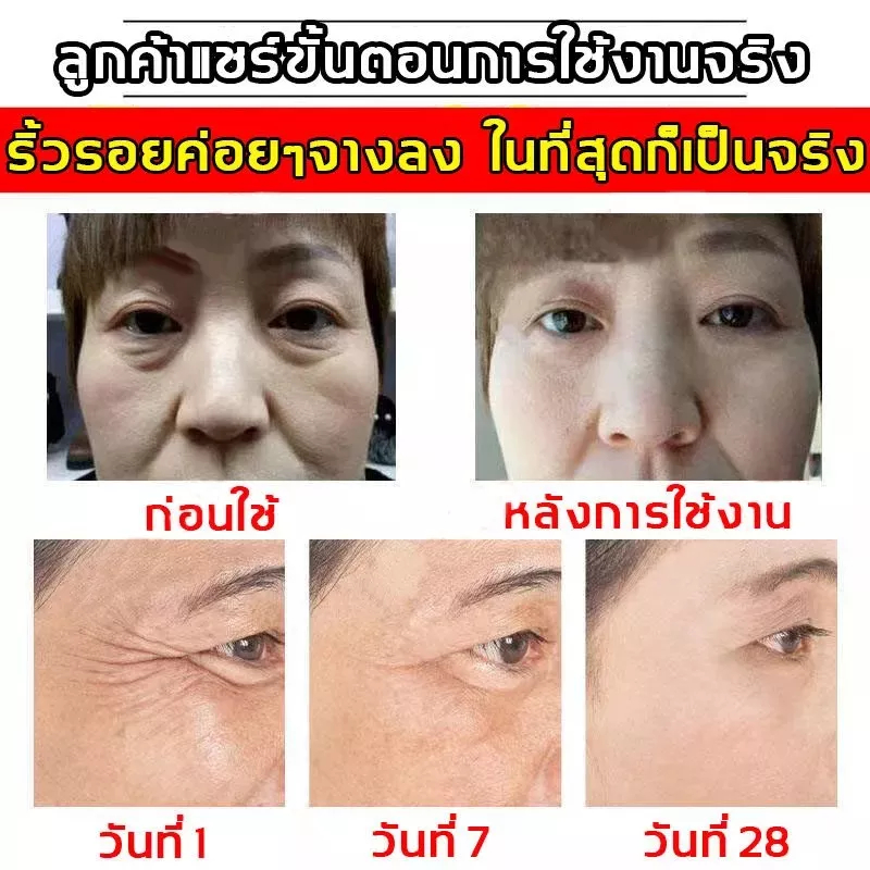 กระชับ/ยกกระชับ เซรั่มหน้าใส ครีมต่อต้านริ้วรอย รอยตีนกา ริ้วรอยหน้าผาก เผยผิวหน้าที่ ครีมต่อต้านริ้วรอย ยกกระชับใบ ราคา ถูกที่สุด ดีลบีเคเค แกลเลอรีภาพที่ 8