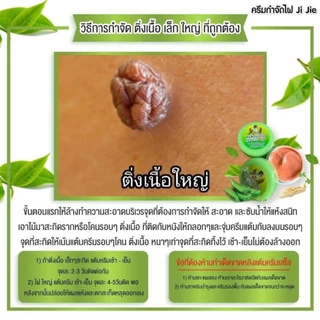 ครีมไฝจีจี้ ขี้แมลงวัน ติ่งเนื้อ หูด ตาปลา แก้ปัญหา กระ สิวหิน ไฝ หูด จี้ไฝ แต้มตาปลา