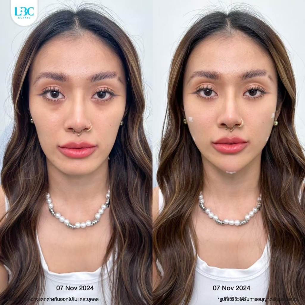 รูปภาพ 2