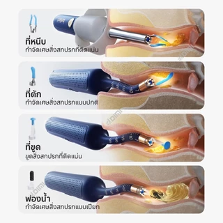 Bebird EarSight Plus R37R ไม้แคะหูอัจฉริยะ สำหรับตรวจ หู จมูก ฟัน I รับประกัน 1 ปี - DIMI
