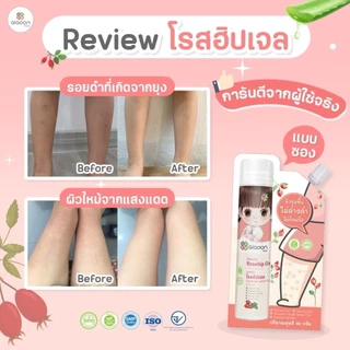 ไออุ่น โรสฮิปเจล บำรุงผิว ลดรอยดำ ขาลายจากยุงกัด ผิวไหม้แดด รอยผื่นร้อน ผื่นคัน แบบซอง 30กรัม