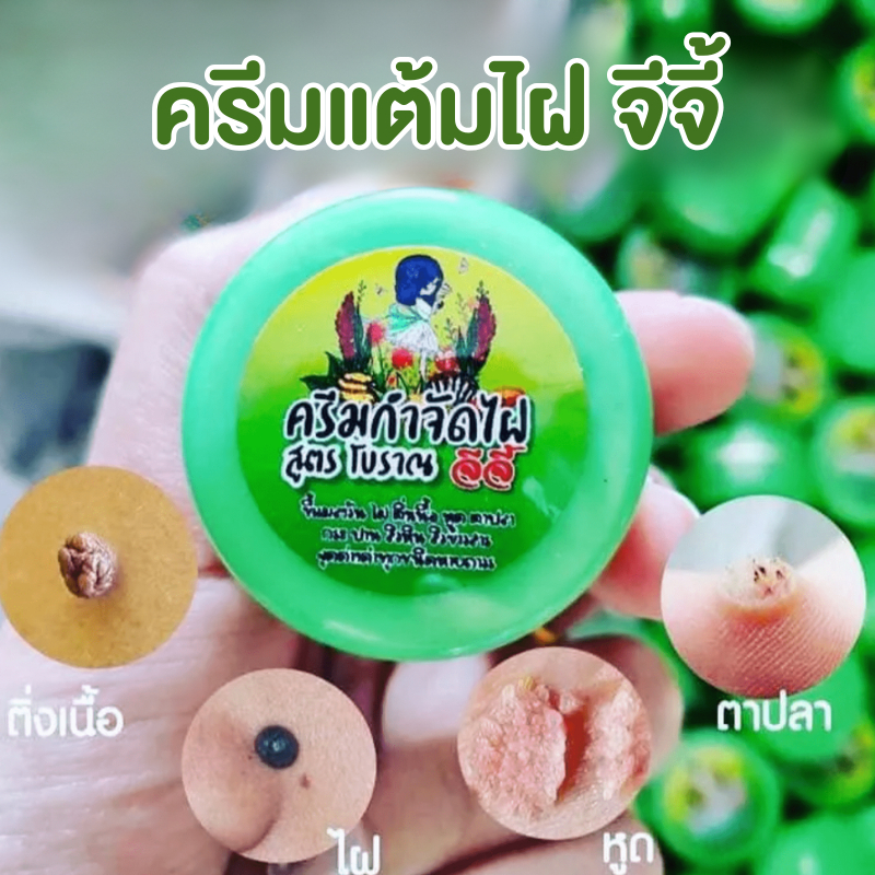 ครีมไฝจีจี้ ขี้แมลงวัน ติ่งเนื้อ หูด ตาปลา แก้ปัญหา สิวหิน ไฝ หูด จี้ไฝ แต้มตาปลา