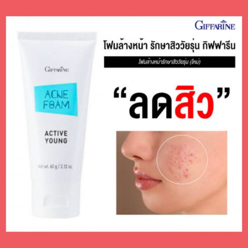 โฟมล้างหน้ารักษาสิว แอคเน่ โฟม แอคทีฟยัง กิฟฟารีน เหมาะสำหรับผู้ที่มีปัญหาเรื่องสิวและวัยรุ่น
